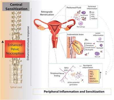 Pain in Endometriosis